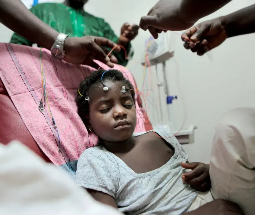 epilepsy in Children